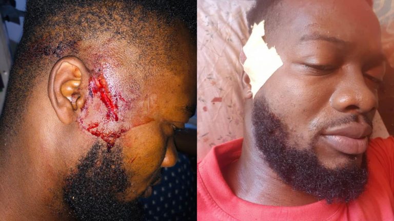 Abdalah Jaysix victime d’une agression à Kinshasa